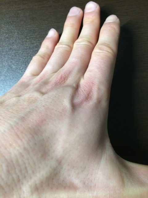 スイムの手